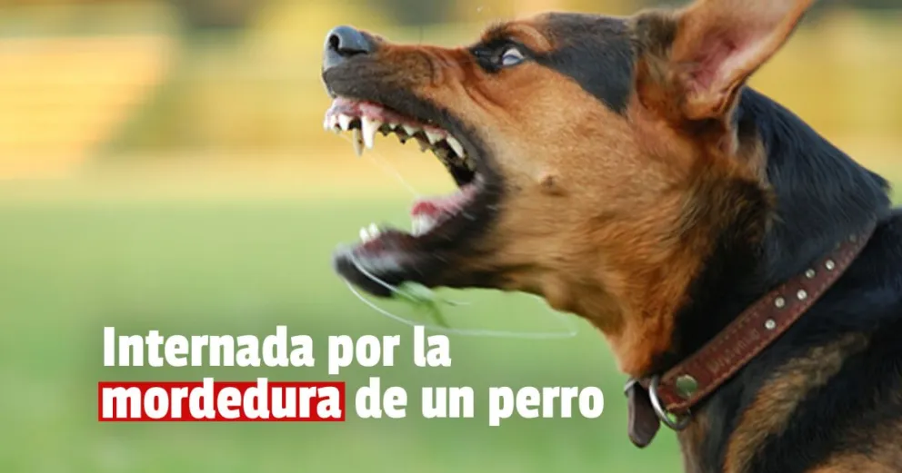 Una nena de 4 años fue mordida en el rostro por un perro 