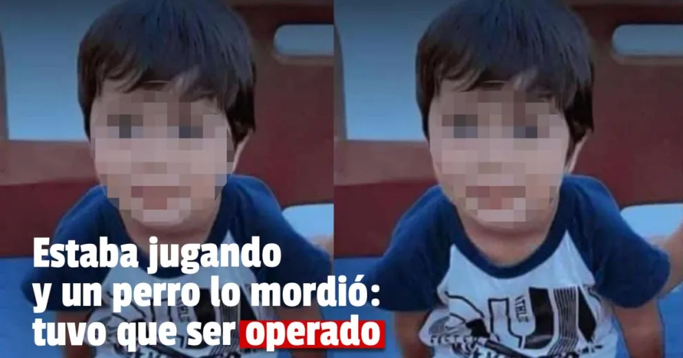 Un menor de dos años fue agredido por un perro