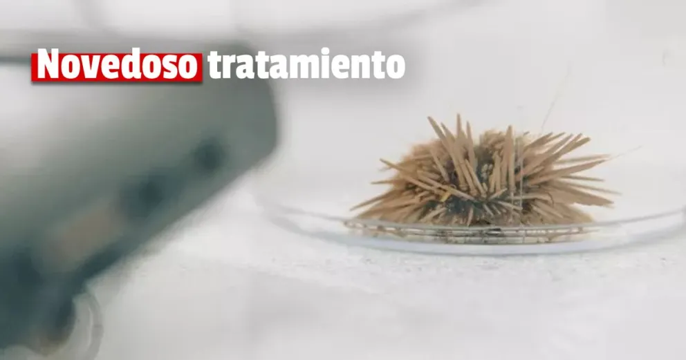 Buscan a pacientes con secuelas de Covid para un tratamiento con erizos de mar