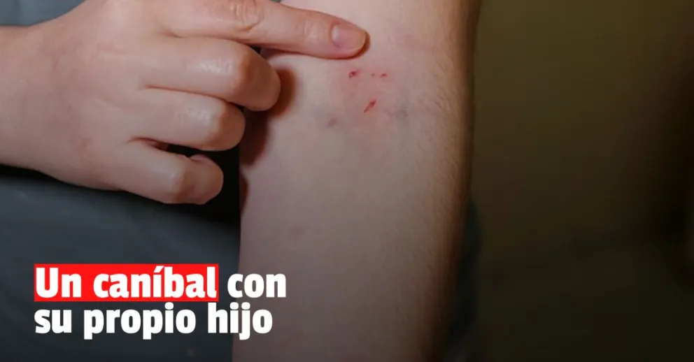 Detuvieron a un joven por morder a su propio hijo