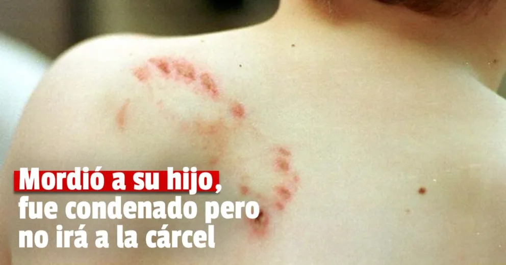 Recibió la sentencia el hombre que mordió a su propio hijo