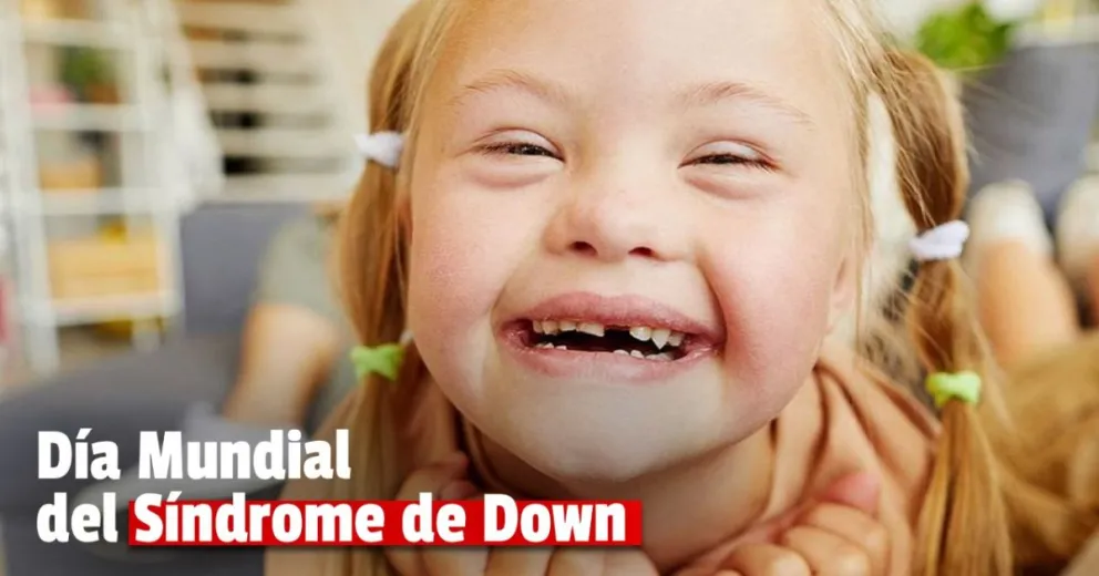  Día Mundial Síndrome de Down: por qué se celebra el 21 de marzo