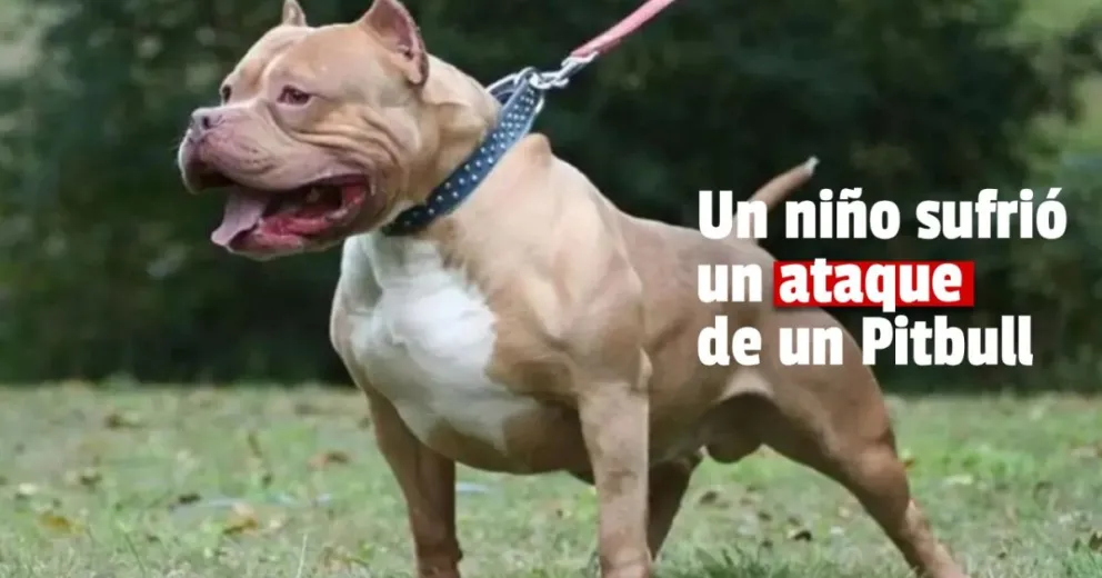 Un niño de 3 años sufrió el ataque en su rostro de un perro pitbull