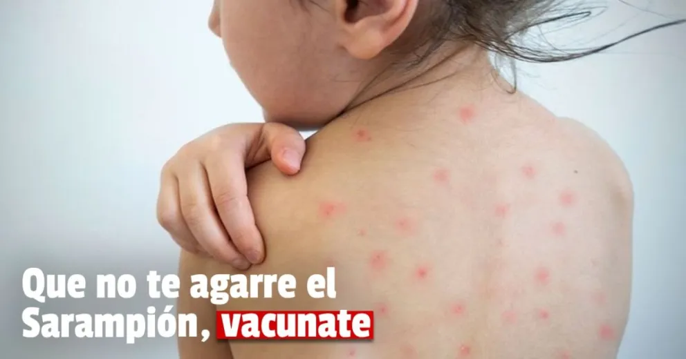 Sarampión: preocupa la baja cantidad de personas vacunadas en la provincia