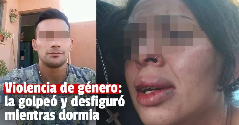 Crudo relato de una mujer agredida en Rivadavia