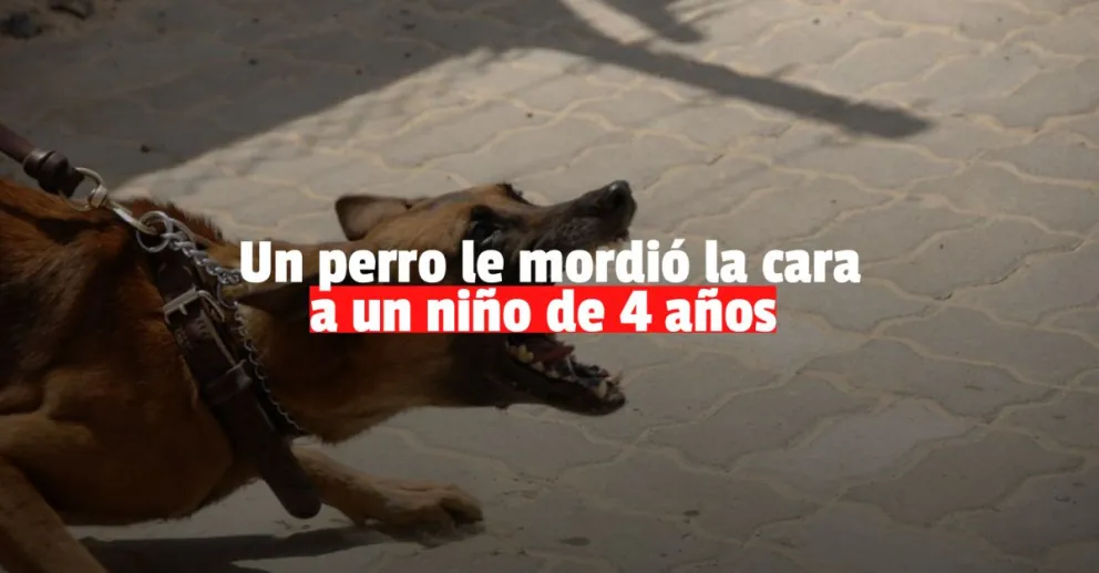 Chimbas: un niño fue atacado por un perro y terminó internado   