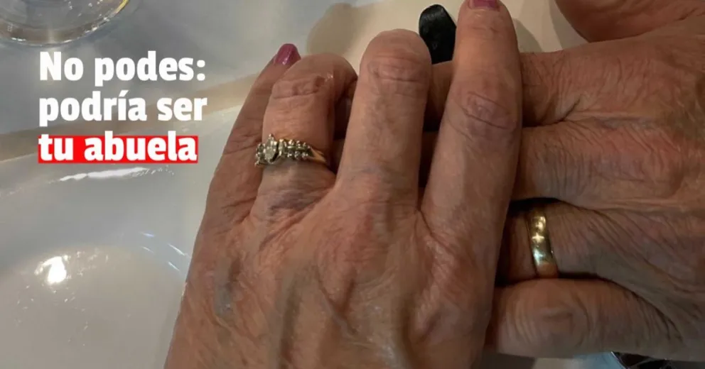 Le dijo que tenia un orzuelo en el ojo y le robó su anillo de oro