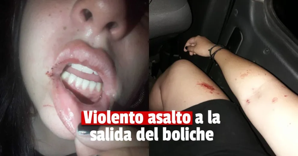 Robo en el estacionamiento de un boliche: su reclamo se viralizó y podrían brindarle una solución 